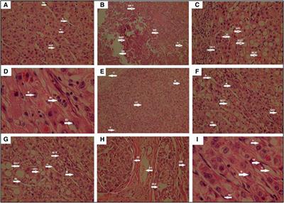 Development of Cholesterol-Lowering and <mark class="highlighted">Detox</mark> Formulations Using Bentonite and Herbal Ingredients